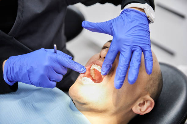 Best Emergency Dental Care for Sports Injuries in Gulf Shores, AL